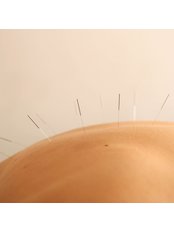 Acupuncture with Grace - Sunshine Coast Acupuncture Clinic