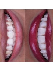 Viltacareclinic - Dental Clinic in Turkey