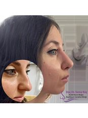 Assoc. Prof. Sema Koc Rhinoplasty Clinic - Ear Nose and Throat Clinic in Turkey