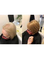 SARIAN - Hair Loss Clinic in Ireland