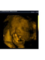 First Choice Baby Scan - General Practice in the UK