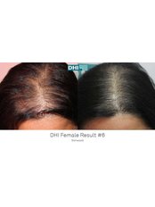 Dr. Rafeek’s Skin & Cosmetic Center - Calicut - Hair Loss Clinic in India