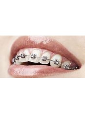 Ortho Dental Clinic Mauritius - braces