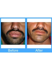 Soni Plastic Surgery and Hair Transplant Centre - Plastic Surgery Clinic in India