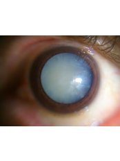 Proscan EyeCare Clinic - Eye Clinic in India