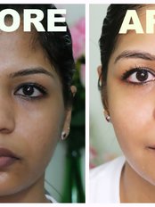 Skin Hair and Cosmetic Clinic - skin whitening treatment
