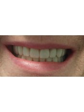 Denture Doctor - Dental Clinic in Australia